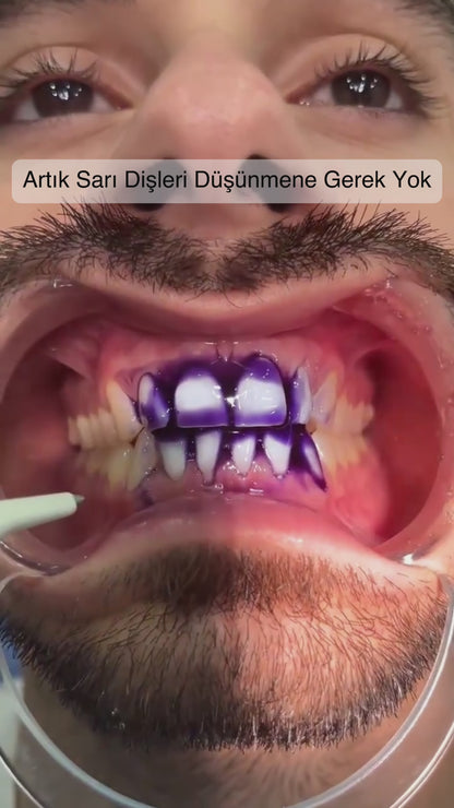 DentaSmile - Anında Beyazlatıcı Diş Macunu